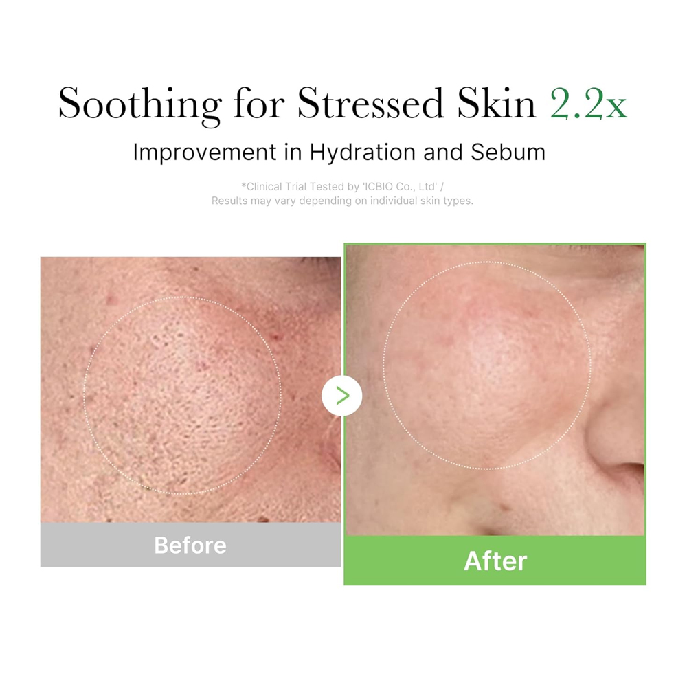 Medicube Exosome Cica Cream 50ml Moisturizing Facial Cream